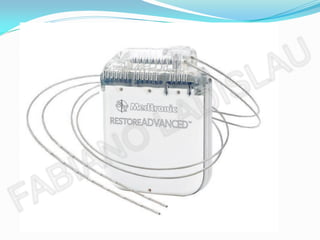 CONTRA INDICAÇÕES
 Stents intravasculares;
 Grampos vasculares extra cranianos;
 Válvulas cardíacas;
 Implantes penianos;
 Implante ocular;
 Corpos estranhos ferrosos intra-ocular;
 Projéteis de armas de fogo e estilhaços;
 Implantes e aparelhos ortopédicos;
 Neuroestimulador.
 