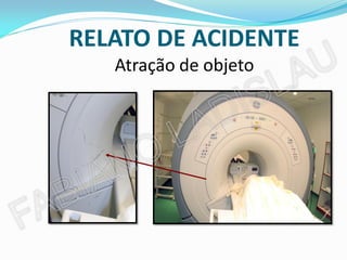 RELATO DE ACIDENTE
   Atração de objeto
 