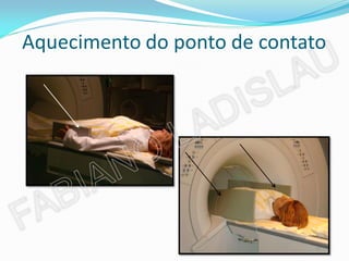 Aquecimento do ponto de contato
 