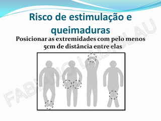 Risco de estimulação e
         queimaduras
Posicionar as extremidades com pelo menos
         5cm de distância entre elas
 