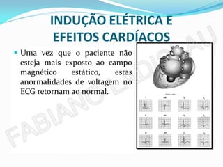INDUÇÃO ELÉTRICA E
           EFEITOS CARDÍACOS
 Biopotenciais o paciente não
  Uma vez que           induzidos
  podem
  esteja mais ser      observados
               exposto ao campo
  durante a exposição a campos
  magnético      estático,   estas
  magnéticos estáticos e são
  anormalidades de voltagem no
  causados pelo sangue – um
  ECG retornam ao normal.
  líquido condutor – ao fluir
  sob a ação de um campo
  magnético;
 Aumento da amplitude da
  onda T.
 