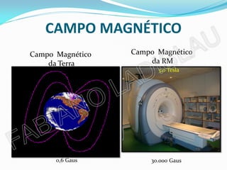 CAMPO MAGNÉTICO
Campo Magnético   Campo Magnético
    da Terra          da RM
                        3,0 Tesla




      0,6 Gaus        30.000 Gaus
 