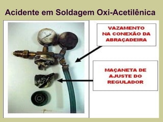 Acidente em Soldagem Oxi-Acetilênica 
 