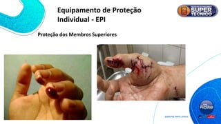 Proteção dos Membros Superiores
Equipamento de Proteção
Individual - EPI
 