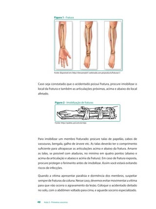 Figura 1 - Fratura 
Fonte: disponível em: http://shevannytst1.webnode.com.pt/products/fraturas1/ 
Caso seja constatado que o acidentado possui fratura, procure imobilizar o 
local da fratura e também as articulações próximas, acima e abaixo do local 
afetado. 
Figura 2 - Imobilização de fraturas 
Fonte: http://aulete.uol.com.br/tala 
Para imobilizar um membro fraturado: procure talas de papelão, cabos de 
vassouras, bengala, galho de árvore etc. As talas deverão ter o comprimento 
suficiente para ultrapassar as articulações acima e abaixo da fratura. Amarre 
as talas, se possível com ataduras, no mínimo em quatro pontos (abaixo e 
acima da articulação e abaixo e acima da fratura). Em caso de fratura exposta, 
procure proteger o ferimento antes de imobilizar. Assim você estará evitando 
riscos de infecções. 
Quando a vítima apresentar paralisia e dormência dos membros, suspeitar 
sempre de fraturas da coluna. Nesse caso, devemos evitar movimentar a vítima 
para que não ocorra o agravamento da lesão. Coloque o acidentado deitado 
no solo, com o abdômen voltado para cima, e aguarde socorro especializado. 
48 Aula 3 - Primeiros socorros 
 