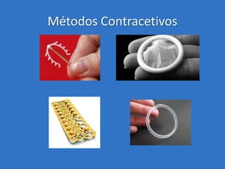Métodos Contracetivos

 