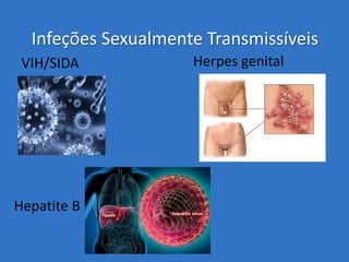 Infeções Sexualmente Transmissíveis
VIH/SIDA

Hepatite B

Herpes genital

 