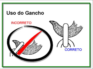 Uso do gancho
 