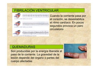 •FIBRILACIÓN VENTRICULAR
                               Cuando la corriente pasa por
                               el corazón, se desestabiliza
                               el ritmo cardíaco. En pocos
                               segundos provoca un paro
                               circulatorio




•QUEMADURAS
Son producidas por la energía liberada al
paso de la corriente. La gravedad de la
lesión depende del órgano o partes del
cuerpo afectadas
 