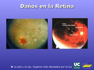 Daños en la Retina    La piel y el ojo, órganos más afectados por la luz 