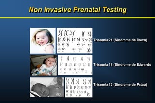 Non Invasive Prenatal Testing
Trisomia 21 (Síndrome de Down)
Trisomia 18 (Síndrome de Edwards
Trisomia 13 (Síndrome de Patau)
 