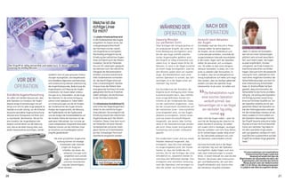 zusätzlich noch ein paar genauere Untersu-
chungen durchgeführt, wie beispielsweise
eine detaillierte allgemeine ophthalmologi-
sche Untersuchung inklusive Untersuchung
des Augenhintergrundes, Bestimmung der
Augendioptrie und Messung des Augen­
innendrucks. Der Zweck dieser Untersu-
chungen ist es, festzustellen, ob das Auge
des Patienten für die sichere Einfügung
solcher Linsen geeignet ist. Dabei helfen
uns Untersuchungen wie die 3D-Analyse
der Vorderkammer des Auges inklusive
Analyse des Augenwinkels, die Messung
der Pupillenbreite mit der Pupillometrie
und die Analyse der Endothelzelldichte auf
der hinteren Fläche der Hornhaut mit der
spekularen Mikroskopie. Nur mit einer ge-
nauen präoperativen Diagnostik eines jeden
Patienten können wir den höchsten Grad
an Sicherheit und Zuverlässigkeit solcher
Eingriffe gewährleisten.
Mit einer gründlichen Augenunter-
suchung können wir etwaige
Krankheiten oder Verände-
rungen am Auge aus-
schließen, bei denen die
refraktive Chirurgie nicht
empfohlen wird und die
sogar zu Komplikationen
und einer Verschlechte-
rung des Sehvermögens
führen könnten.
Zwanzig Minuten
zur perfekten Sicht
VDas Einfügen der Intraokularlinse ist
ein ambulanter Eingriff, der unter ört­
licher Betäubung durchgeführt wird,
bei der das Auge mithilfe anästhe-
tischer Augentropfen gelähmt wird.
Der Eingriff ist völlig schmerzfrei und
relativ kurz, er dauert etwa 20 bis 30
Minuten. Er wird in der Regel zunächst
an einem Auge durchgeführt, zwei bis
drei Wochen später dann am zweiten
Auge. Die Rehabilitation nach einer
solchen Operation ist schnell, das Seh­
vermögen ist in der Regel schon am
nächsten Tag normal.
Das Grundprinzip der Korrektur der
Dioptrie durch Einfügung einer Intrao-
kularlinse besteht darin, dass mithilfe
eines einige Millimeter breiten Ein­
schnitts an der Vorderseite des Auges
vor der natürlichen Augenlinse – bzw.
bei der intraokularen Kontaktlinse auf
der natürlichen Linse – eine künstliche
Linse eingesetzt wird, um die Augen-
dioptrie zu korrigieren. Solche Linsen
sind aus einem Kunststoff-Polymer
hergestellt, das bereits über fünfzig
Jahre in der Kataraktchirurgie verwen-
det wird. Diese Linsen sind qualitativ
hochwertig und wurden umfassend
geprüft.
Die modernsten Linsen sind aus einem
flexiblen Material hergestellt, das
ermöglicht, dass die Linse verbogen
ins Auge eingesetzt wird. Der Vorteil
hierbei ist, dass die Größe des Ein­
schnitts, die für das Einfügen der Linse
erforderlich ist, wesentlich kleiner ist
und etwa drei Millimeter beträgt. Dies
ermöglicht eine schnellere Genesung
nach der Operation und verringert zu-
dem die Gefahr von Komplikationen.
Vorsicht beim Belasten
der Augen
Unmittelbar nach der Ankunft in Ihrem
Zuhause sollten Sie damit beginnen,
die Tropfen, die ein Antibiotikum und
Corticosteroide enthalten, innerhalb der
vorgeschriebenen Intervalle einzutröpfeln.
In den ersten Tagen nach der Operation
sollten Sie versuchen, sich zu entspan-
nen. Sie sollten es über einen längeren
Zeitraum­vermeiden, zu lesen, am Com-
puter zu arbeiten oder fernzusehen. Es
ist möglich, dass Sie vorübergehend ein
wenig empfindlicher auf helles Licht reagi-
eren werden, dass Sie häufiger geblendet
werden und dass das operierte Auge
tränenreicher ist als sonst. Sie sollten sich
daher nicht die Augen reiben – seien Sie
auch bei der Reinigung des Gesichts mit
einem Handtuch vorsichtig. Sie sollten
sich zudem nicht in staubigen, rauchigen
Räumen aufhalten und nicht Auto fahren,
bis Ihr Sehvermögen wieder völlig scharf
ist. Die Sehschärfe verbessert sich nach
der Operation unterschiedlich schnell.
Die erste Kontrolle wird in der Regel
am nächsten Tag nach der Operation
durchgeführt. Später folgen noch eine
oder zwei Untersuchungen in unserer
Klinik, in einem Intervall von zwei bis drei
Wochen. Die Kosten aller Untersuchun-
gen und Medikamente, die nach dem
Eingriff erforderlich sind, sind im Preis
des refraktiven Eingriffes enthalten.
DiephakeIntraokularlinse wird
indieVorderkammer desAuges
eingeführt.Ihr Zweckistes,die
unangemesseneBrechkraft
der Hornhautundder natürli-
cheAugenlinsezu korrigieren.
Gleichzeitigermöglichtsiedie
Erhaltungder natürlichenAugen-
linseunddamitauchder Akkom-
modation.Sieistfür Patienten
biszum40.Lebensjahr geeignet,
bei welchennochdienatürliche
Fähigkeitder Akkommodation
erhaltenundeineausreichend
tiefeVorderkammer vorhanden
ist,diedasEinfügeneiner sol-
chenLinseermöglicht.Darüber
hinausmussder Patientüber
einegesundeHornhautmiteiner
geeignetenDichteanEndothel-
zellenverfügen,diedieRücksei-
teder Hornhautbedecken.
Die intraokulare Kontaktlinse ICL
wird hinter der Regenbogenhaut
direkt an die natürliche Augen-
linse platziert. Sie ermöglicht die
Erhaltung sowohl der natürlichen
Augenlinse als auch der Akkom-
modation. Diese Linse kann auch
bei Patienten mit einer flachen
Vorderkammer und einer niedri-
geren Dichte an Endothelzellen
auf der rückseitigen Hornhaut­
oberfläche eingesetzt werden.
Welcheistdie
richtigeLinse
fürmich?
„Nach15JahrenmitKontaktlin-
senhatsichmeinSehvermögen
plötzlichsehrschnellverschlech-
tert,auchbeimLesen,dieAugen
wurdenempfindlich,trocken
undgereizt,amEndemussteich
manchmalzweiArtenvonBrillen
tragen.Dieswarnichtdiepassende
Lösungfürmich,weshalbichmich
nacheinermöglichenKorrekturder
Sehschärfeerkundigtundmichfür
eineUntersuchungentschieden
habe.Dr.KristinaMikekhatfest-
gestellt,dasseineKorrekturder
SehschärfefürdieFerneundNähe
nötigsei.SieschlugeineOperation
mitEinfügungeinerneuenAcryl-
linsevonhöchsterQualitätvor.Vor
derOperationerklärtesiemirden
gesamtenAblaufderOperationso-
wiedenHeilungsprozessundgab
mirdienotwendigeLiteraturandie
Hand,sodassichmichselbstvon
derOperationüberzeugenkonnte.
DerEingriffdauerteetwaeinehalbe
Stundeundwarnichtschmerzhaft.
SchonamnächstenTaghabeich
mitdemoperiertenAugewieder
sehrgutgesehen,sodassichnach
zweiWochenzuversichtlichaufden
EingriffamanderenAugegewartet
habe.“
Manja Kerstein, Juristin
Die Rehabilitation nach
einer solchen Operation
verläuft schnell, das
Sehvermögen ist in der Regel
am nächsten Tag völlig
normal.
Gründliche Augenuntersuchung
Sie sollten sich darüber bewusst sein, dass
jede Operation zur Korrektur der Augen-
dioptrie einige Einschränkungen mit sich
bringt und nicht für jedes Auge geeignet ist.
Deshalb ist es sehr wichtig, vor der Entschei-
dung eine gründliche Augenuntersuchung
inklusive einer Rücksprache mit Ihrem Arzt
zu durchlaufen. Bei Personen, die sich für
eine Korrektur der Augendioptrie inter-
essieren und bei denen wir der Meinung
sind, dass es die beste Lösung wäre, eine
phake Intraokularlinse einzufügen, werden
Der Eingriff ist völlig schmerzfrei und relativ kurz. Er dauert ungefähr
zwanzig bis dreißig Minuten.
Intraokulare Kontaktlinse
ICL nach Einfügen ins Auge
Intraokularlinse
Für eine kostenlose und unverbindliche
Untersuchung Ihrer Augen sowie eine
Beratung mit einem Arzt über die
Möglichkeiten der dauerhaften Korrektur der
Augendioptrie rufen Sie bitte das Zentrum
Morela okulisti unter der Telefonnummer
+386 1 51 02 340 an. Die Untersuchung kann
in Ljubljana oder Bled durchgeführt werden.
Während der
Operation
Nach der
Operation
Vor der
Operation
20 21
 