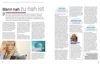 zwischen den einzelnen Herstellern in Bezug
auf die Optik. Der Arzt stellt dem Patienten
während der eingehenden Untersuchung
vor, welche Intraokularlinsen für sein Auge
geeignet wären und was er von seinem
Seh­vermögen nach einer Operation erwar-
ten kann. Anschließend treffen in der Regel
beide gemeinsam die Entscheidung, welche
Linse verwendet werden soll, die dann für
den Patienten bestellt wird.
Wenn nah zu nah istMag. Kristina Mikek, Dr. med., Spez. der Ophthalmologie
Nach dem 40. Lebensjahr beginnt die Fähigkeit der okularen Akkommodation, also
der Anpassung der Brechkraft der Augenlinse bei Nah- und Weitsicht, allmählich
abzunehmen. Dies äußert sich als weniger scharfe Nahsicht, in der Regel zuerst als
Problem beim Lesen von Kleingedrucktem bei schlechteren Lichtverhältnissen. Diesen
Zustand nennt man Alterssichtigkeit oder Presbyopie.
Wer ist für diesen Eingriff
geeignet?
Wie bei anderen Operationen zur Korrektur
der Augendioptrie muss vor der Entschei-
dung über eine Einfügung einer multifoka-
len Linse eine detaillierte Untersuchung der
Augen durchgeführt werden. Bereits bei der
ersten informativen Untersuchung können
wir, basierend auf den Formen der refrak-
tiven Erkrankung, dem Patienten mitteilen,
ob in seinem Fall auch die Korrektur der
Alterssichtigkeit möglich ist. Wenn sich der
Patient für den Eingriff entscheidet, folgt
eine ausführliche Untersuchung, bei der die
Möglichkeit von pathologischen Verände-
rungen im hinteren Teil des Auges (alters-
bedingte Degeneration des gelben Flecks,
andere pathologische Veränderungen im
gelben Fleck, diabetische Retinopathie,
Netz­hauterkrankungen durch Gefäßversc-
hlüsse etc.) ausgeschlossen wird. Andernfalls
könnte der Eingriff nicht durchgeführt wer-
den. Auch Patienten mit einer entwickelten
Form von Glaukom oder mit Verletzungen
an der Hornhaut sind nicht für den Eingriff
geeignet. Bei dieser Untersuchung führen
wir auch alle notwendigen biometrischen
Messungen des Auges durch, die die
Grundlage für die Berechnung der Dioptrie
der Linse bilden. Jede multifokale Linse wird
direkt beim Hersteller individuell bestellt und
mit optischen Eigenschaften, die genau auf
das Auge eines jeden einzelnen Patienten
angestimmt sind, hergestellt.
Es gibt mehrere multifokale Linsen, die sich
geringfügig voneinander in Bezug auf die
optischen Eigenschaften unterscheiden. Bei
Personen, die neben Kurzsichtigkeit oder
Weitsichtigkeit und begleitender Alterssich­
tigkeit auch unter Astigmatismus leiden,
entscheiden wir uns in der Regel für das
Einfügen einer torischen Multifokallinse,
die auch den Astigmatismus korrigiert.
Es gibt auch einige kleinere Unterschiede
Eingriff wie beim grauen Star
Die Operation ist die gleiche wie beim grau­
en Star. Die Operation wird unter lokaler
Betäubung mit Tropfen durchgeführt.
Mithilfe eines kleinen Schnitts am Rande
der Hornhaut, der nur drei Millimeter misst,
wird die natürliche Augenlinse, die über kei-
Gewöhnungsphase
In der postoperativen Phase muss sich der
Patient zunächst an die multifokale Linse
gewöhnen und anpassen. Er muss lernen,
sowohl in die Ferne als auch in die Nähe zu
sehen. Dies kann bis zu mehreren Wochen
oder Monaten nach der Operation dauern.
Jedoch sind über 80 Prozent der Patienten
nach dem Einfügen einer solchen Linse
in beide Augen völlig unabhängig von
ihrer Brille. Sie können Bücher lesen, einen
Computer verwenden, Auto fahren – bei
Tag und bei Nacht –, Sport treiben, und das
alles ohne Brille. Trotz der bewährten guten
Ergebnisse bei der Verwendung dieser
Linsen ist es möglich, dass einige Patienten
für anspruchsvollere Arbeiten oder bei
schlechten Lichtverhältnissen noch eine Brille
benötigen werden.
„Da ich eine hohe Dioptrie
sowohl beim Lesen als auch
beim Sehen in die Ferne hatte,
habe ich mich nach der Beratung
mit Dr. Kristina Mikek für eine
Laserkorrektur entschieden. Der
Eingriff wurde sehr professionell
und schnell durchgeführt. Nach
der Operation hatte ich keine
Probleme und keine Schmerzen.
Ich freue mich sehr, weil ich in
die Nähe und Ferne sehr gut
sehe, und ich brauche sogar
keine Brille mehr.“
Peter Marter, ehemaliger
Basketballspieler
D
er Zeitpunkt des Auftretens dieser
Probleme ist sehr unterschiedlich, in
der Regel zeigen sie sich bei Perso-
nen, die bisher eine geringe Weitsichtigkeit
hatten, also eine leichte positive Dioptrie,
am frühesten. Personen, die einen minimal­
en Grad an Kurzsichtigkeit aufweisen, d. h.
eine Dioptrie von -0,25 bis -0,5, kommen
am längsten ohne Lesebrille aus.
Die Ursachen für die Entwicklung einer
Presbyopie ist noch nicht gut erforscht,
eine wichtige Rolle dabei spielt jedoch
sicherlich die Reduzierung der Flexibilität
der natürlichen Augenlinse. Im Laufe der
Jahre nimmt der Grad der Alterssichtig-
keit zu, sodass früher oder später jeder
eine Lesebrille benötigt. Als erfolgreiche
Alternative zur lebenslangen Verwendung
einer Lesebrille hat sich in den vergange-
nen Jahren das Einfügen einer multifoka-
len Intraokularlinse herausgestellt. Dies ist
ein relativ kleiner Eingriff unter örtlicher
Betäubung, wobei die defekte natürliche
Augenlinse durch eine künstliche Linse
mit einer komplexen multifokalen Optik,
die gute Nahsicht und scharfe Fernsicht
ermöglicht, ersetzt wird.
Premium-Linsen
So werden zusammenfassend alle multi-
fokalen Linsen mit komplexer multifokaler
Optik bezeichnet, die die Akkommodation
einer gesunden und natürlichen Augenlin-
se nachahmt. Ursprünglich wurden diese
Linsen nur bei Patienten mit grauem Star
verwendet, die mit der Operation auch ihre
Lesebrille loswerden wollten. Aufgrund der
außergewöhnlichen Effizienz hat sich die In-
dikation für den Einsatz von Premium-Linsen
in den letzten Jahren sehr erweitert, und
nun werden diese Linsen auch bei Patienten
mit Alterssichtigkeit verwendet, bei denen
die natürliche Augenlinse nur altersbedingt
verändert ist und die einfach keine Lese-
brille mehr wollen. Für das Einfügen einer
solchen Linse sind diejenigen Personen am
besten geeignet, die bereits eine bestimmte
Stufe der Weit- oder Kurzsichtigkeit erreicht
haben und bei denen sich bereits eine be-
gleitende Alterssichtigkeit abzeichnet.
Für ein gutes Ergebnis der Operation ist es
wichtig, die Patienten sorgfältig auszuwäh-
len, doch leider sind nicht alle Patienten für
einen solchen Eingriff geeignet. Es ist sehr
wichtig, dass der Patient das Funktions-
prinzip der Linse versteht und realistische
Erwartungen hat.
ne Akkommodation mehr verfügt, entfernt.
An ihre Stelle wird eine künstliche Linse ein-
gesetzt. Wenn diese multifokal ist, bedeu­tet
das, dass sie derart gefertigt ist, dass sie
mehrere Brennweiten hat, die die Fokussie-
rung des Lichts auf den Augenhintergrund
ermöglichen, sowohl in der Ferne als auch
in der Nähe. Die gesamte Operation ist sehr
kurz, sie dauert 10 bis 15 Minuten und
kann an beiden Augen gleichzeitig durch­
geführt werden. Die Operation ist völlig
schmerzfrei, und auch in der postoperativen
Phase treten in der Regel keine Schmerzen
auf. Durch das Einfügen der Multifokallinse
wird neben der Alterssichtigkeit zusätzlich
eine mögliche Kurzsichtigkeit, Weitsichtigk­
eit sowie Astigmatismus korrigiert.
Eine multifokale Intraokularlinse
ermöglicht ein besseres
Sehvermögen für Nah- und
Weitsicht.
Für eine kostenlose und unverbindliche
Untersuchung Ihrer Augen sowie eine
Beratung mit einem Arzt über die
Möglichkeiten der dauerhaften Korrektur der
Augendioptrie rufen Sie bitte das Zentrum
Morela okulisti unter der Telefonnummer
+386 1 51 02 340 an. Die Untersuchung kann
in Ljubljana oder Bled durchgeführt werden.
Während der
Operation
Nach der
Operation
Vor der
Operation
22 23
Korrektur der Alterssichtigkeit durch Einfügung einer Intraokularlinse
 