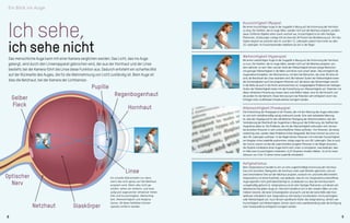 Kako poteka operacija
Operacija poteka ambulantno v lokalni anesteziji s kapljicami in traja približno 45 minut. S
površine roženice odstranimo tanek zaščitni sloj epitelnih celic. Tkivo roženice zatem pre-
pojimo s posebno raztopino vitamina B2 (riboflavina) in obsevamo z ultravijolično svetlobo
natančno določene valovne dolžive (UVA-žarki). Na koncu v oko vstavimo terapevtsko kon-
taktno lečo, ki površino roženice varuje prve dni po posegu. Po operaciji se lahko pojavijo
bolečine zaradi celjenja površine roženice, ki lahko trajajo od dva do tri dni, praviloma pa le
en dan po operaciji. Pomembno je vedeti, da je vid takoj po operaciji slabši in se šele nato v
nekaj tednih izboljša.
Ich sehe,
ich sehe nicht
Das menschliche Auge kann mit einer Kamera verglichen werden. Das Licht, das ins Auge
gelangt, wird durch den Linsenapparat gebrochen wird, der aus der Hornhaut und der Linse
besteht; bei der Kamera führt die Linse diese Funktion aus. Dadurch entsteht ein scharfes Bild
auf der Rückseite des Auges, die für die Wahrnehmung von Licht zuständig ist. Beim Auge ist
dies die Netzhaut, bei der Kamera der Lichtsensor.
Astigmatismus
Beim Astigmatismus handelt es sich um eine ungleichmäßige Krümmung der Hornhaut.
Das Licht wird beim Überqueren der Hornhaut unter zwei Winkeln gebrochen und auf
zwei verschiedene Orte auf der Netzhaut projiziert, wodurch ein unscharfes Bild entsteht.
Astigmatismus ist keine Krankheit, was bedeutet, dass ein von Astigmatismus betroffenes
Auge eigentlich nicht groß beeinträchtigt ist, es bedeutet nur, dass die Hornhaut leicht
unregelmäßig geformt ist. Astigmatismus ist ein sehr häufiges Phänomen und deutet sich
teilweise bei fast jedem Auge an. Dennoch handelt es sich in den meisten Fällen um eine
mildere Variante, die keine Schwierigkeiten verursacht und bei der keine Brille oder Kon-
taktlinsen erforderlich sind. Astigmatismus tritt häufig in Kombination mit Kurzsichtigkeit
oder Weitsichtigkeit auf. Auch klinisch signifikante Stufen des Astigmatismus, ähnlich wie
Kurzsichtigkeit und Weitsichtigkeit, können durch eine Laserbehandlung oder die Einfügung
einer Intraokularlinse erfolgreich korrigiert werden.
Kurzsichtigkeit (Myopie)
Bei einem kurzsichtigen Auge ist der Augapfel in Bezug auf die Krümmung der Hornhaut
zu lang. Die Strahlen, die ins Auge fallen, werden nicht auf die Netzhaut projiziert, sondern
davor. Entfernte Objekte sehen somit unscharf aus. Kurzsichtigkeit ist ein sehr häufiges
Phänomen, Schätzungen zufolge tritt sie etwa bei 30 Prozent der Bevölkerung auf. Am häu-
figsten beginnt sie zwischen dem 8. und dem 12. Lebensjahr, jedoch fast immer vor dem
20. Lebensjahr. Im Erwachsenenalter stabilisiert sie sich in der Regel.
Weitsichtigkeit (Hyperopie)
Bei einem weitsichtigen Auge ist der Augapfel in Bezug auf die Krümmung der Hornhaut
zu kurz. Die Strahlen, die ins Auge fallen, werden nicht auf die Netzhaut projiziert, son-
dern dahinter. Je nach Alter und der Stufe der Weitsichtigkeit können einige Menschen
mit geringer Weitsichtigkeit in die Nähe und Ferne noch scharf sehen. Dies ermöglicht die
Augenakkommodation, der Mechanismus, mit dem bei Menschen, die unter 40 Jahre alt
sind, die Brechkraft der Linse verändert wird. Bei höheren Stufen der Weitsichtigkeit treten
die Schwierigkeiten auch bei jüngeren Personen auf, bei denen das Sehvermögen sowohl
in die Nähe als auch in die Ferne verschwommen ist. Ausgeprägtere Probleme bei niedrigen
Stufen der Weitsichtigkeit treten mit der Entwicklung von Alterssichtigkeit auf. Patienten mit
dieser refraktiven Erkrankung müssen dann zwei Brillen haben, eine für die Fernsicht und
die andere für die Nahsicht. Diese Störung kann bei Patienten sehr erfolgreich durch das
Einfügen einer multifokalen Intraokularlinse korrigiert werden.
Alterssichtigkeit (Presbyopie)
Die Entwicklung der Presbyopie ist ein Prozess, der mit der Alterung des Auges verbunden
ist und noch verhältnismäßig wenig untersucht wurde. Eine weit verbreitete Meinung
ist, dass der Hauptgrund für den allmählichen Rückgang der Akkommodation, also der
Veränderung der Brechkraft der Augenlinse in Bezug auf die Entfernung, die Steifheit der
Augenlinse selbst ist. Die Probleme, die mit der Alterssichtigkeit verbunden sind, können
bei einzelnen Personen in sehr unterschiedlicher Weise auftreten. Von Personen, die etwas
weitsichtig sind, werden diese Probleme früher festgestellt. Bei ihnen können sie schon vor
dem 40. Lebensjahr auftreten. In der Regel können Personen mit minimaler Kurzsichtigkeit
am längsten ohne Lesebrille auskommen, einige sogar bis zum 60. Lebensjahr. Dies ist auch
der Grund, warum wir bei der Laser-Korrektur jüngerer Personen in der Regel versuchen,
die Dioptrie mindestens eines Auges leicht nach unten zu korrigieren, was bedeutet, dass
im Falle einer Kurzsichtigkeit mindestens -0,25 Dioptrien erhalten bleiben. So ist für einen
Zeitraum von 5 bis 10 Jahren keine Lesebrille erforderlich.
Ein scharfes Bild entsteht nur dann,
wenn das Licht genau auf die Netzhaut
projiziert wird. Wenn dies nicht ge-
schieht, sehen wir schlecht, und zwar
aufgrund sogenannter refraktiver Fehler.
Dies sind Kurzsichtigkeit, Weitsichtig-
keit, Alterssichtigkeit und Astigma-
tismus. All diese Sehfehler können
operativ entfernt werden.
Regenbogenhaut
Hornhaut
Pupille
Linse
Glaskörper
Gelber
Fleck
Netzhaut
Optischer
Nerv
8 9
Ein Blick ins Auge
 