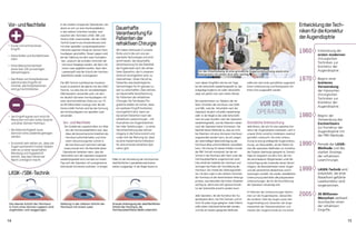 sollte erst nach einer gründlichen augenärzt-
lichen Untersuchung und Rücksprache mit
Ihrem Arzt ausgewählt werden.
Vor der
Operation
Gründliche Untersuchung
Jede Person, die sich für eine operative Kor-
rektur der Augendioptrie interessiert, wird in
unserer Klinik zunächst mindestens zweimal
gründlich untersucht. Die erste Untersu-
chung ist eine grundlegende Augenuntersu-
chung, um festzustellen, ob der Patient für
eine der operativen Methoden zur Korrektur
der Dioptrie überhaupt geeignet ist. Danach
folgt ein Gespräch mit dem Arzt, der ihm
die verschiedenen Möglichkeiten unter Be-
rücksichtigung des Zustandes seines Sehver-
mögens, der Besonderheiten seiner Augen
und der persönlichen Bedürfnisse und Er-
wartungen vorstellt. Die zweite, detailliertere
Untersuchung beinhaltet alle präoperativen
Untersuchungen, die für die Durchführung
der Operation notwendig sind.
Im Rahmen der Untersuchungen bestim-
men wir die Augendioptrie, überprüfen
die vorderen Teile des Auges sowie den
Augenhintergrund, bewerten die Ange-
messenheit der Tränenproduktion und
messen den Augeninnendruck mit einem
nach diesen Eingriffen drei bis vier Tage,
bis die Sehschärfe wiederhergestellt ist; das
endgültige Ergebnis mit voller Sehschärfe
zeigt sich jedoch erst nach einem Monat.
Bei Lasertechniken zur Ablation der tie-
feren Schichten der Hornhaut, wie LASIK
und SBK, wird die Sehschärfe nach der
Operation deutlich schneller wiederherge-
stellt. In der Regel ist die volle Sehschärfe
nach ein paar Stunden nach der Operation
wiederhergestellt, und die Patienten haben
nach der Operation keine Schmerzen. Der
Nachteil dieser Methode ist, dass sie nicht
bei Patienten mit einer dünneren Hornhaut
angewendet werden kann, da sich wegen
der übermäßigen Beeinträchtigung der
Hornhaut diese unkontrollierbar auswölben
kann. Als Lösung für dieses Problem wurde
die SBK-Technik entwickelt, bei der ein
Schnitt in die Hornhaut sehr flach unter der
Hornhautoberfläche vorgenommen wird.
Dies erhält die Stabilität der Hornhaut und
verringert das Risiko der Vorwölbung der
Hornhaut. Der Vorteil der Glättungsverfah-
ren mit dem Laser in den tieferen Schichten
der Hornhaut ist der berechenbare Heilungs-
prozess, was besonders bei hohen Dioptrien
wichtig ist, damit eine sehr genaue Korrek-
tur der Sehschärfe erreicht werden kann.
Jede Operation, die der Korrektur der Au-
gendioptrie dient, hat ihre Grenzen und ist
nicht für jedes Auge geeignet. Jeder Patient
sollte daher individuell behandelt werden,
und die am besten geeignete Methode
Wir haben Vertrauen in unsere
Ärzte und in die von uns ver-
wendete Technologie und sind
somit bereit, die dauerhafte
Verantwortung für die Stabilität
der Ergebnisse nach der refrak-
tiven Operation, die in unserem
Zentrum durchgeführt wird, zu
übernehmen. Unser Ziel ist es,
Patienten das bestmögliche
Sehvermögen für ihr ganzes Le-
ben zu verschaffen. Dies nennen
wir dauerhafte Verantwortung
für Patienten der refraktiven
Chirurgie. Als Teil dieses Pro-
gramms stellen wir sicher, dass
ein weiterer Eingriff kostenlos
durchgeführt wird, wenn es
bei einem Patienten nach der
refraktiven Laserchirurgie – mit
Ausnahme von Augenkrankhei-
ten oder Verletzungen – zu einer
Verschlechterung des Sehver-
mögens in die Ferne kommt und
unser Arzt der Meinung ist, dass
es eine medizinische Indikation
für eine erneute refraktive Ope-
ration gibt.
Dauerhafte
Verantwortungfür
Patientender
refraktivenChirurgie
1960
1970
1980
1990
1999
2005
Entwicklung der
ersten modernen
chirurgischen
Techniken zur
Korrektur der
Augendioptrie.
Beginn einer
breiteren
Verwendung
der klassischen
chirurgischen
Techniken zur
Korrektur der
Augendioptrie.
Beginn der
Verwendung des
Excimerlasers
zur Korrektur der
Augendioptrie mit
der PRK-Methode.
Periode der LASIK-
Methode und des
starken Anstiegs
der refraktiven
Laserchirurgie.
LASEK-Technik wird
entwickelt, die erste
Wavefront-geführte
Laserkorrektur wird
vorgenommen.
30 Millionen
Menschen weltweit
durchlaufen einen
der refraktiven
Eingriffe.
Vor-undNachteile
LASIK-/SBK-Technik
EntwicklungderTech-
nikenfürdieKorrektur
derAugendioptrie
•	 Kurzer und schmerzloser
Eingriff.
•	 Keine Brillen und Kontaktlinsen
mehr.
•	 Hohe Wahrscheinlichkeit
eines fast 100-prozentigen
Sehvermögens.
•	 Das Risiko von Komplikationen
während des Eingriffs ist
minimal, alle Komplikationen
sind gut kontrollierbar.
•	 Der Eingriff eignet sich nicht für
Menschen mit sehr hoher Dioptrie
und einer dünnen Hornhaut.
•	 Bei Alterssichtigkeit muss
dennoch eine Lesebrille getragen
werden.
•	 Es kommt sehr selten vor, dass die
Augen permanent trocken bleiben
oder es zu einer dauerhaften
Blendung und Doppelsicht
kommt, was das Fahren bei
Nacht unmöglich macht.
+
-
In der zweiten Gruppe der Operationen, bei
denen es sich um eine Hornhautablation
in den tieferen Schichten handelt, wird
zwischen den Techniken LASIK, SBK und
Femto-LASIK unterschieden. Bei der LASIK-
Technik (Laser-in-situ-Keratomileusis) wird
mit einer speziellen computergesteuerten
mikrochirurgischen Klinge ein dünner Horn-
hautlappen geschaffen. Dieser Lappen wird
bei der Glättung mit dem Laser hochgeho-
ben, wodurch die zentralen Schichten der
Hornhaut freigelegt werden, die dann mit
einem Laser geglättet werden. Nach dem
Lasereingriff wird die Schicht der Hornhau-
toberfläche wieder zurückgesetzt.
Die SBK-Technik (sub-Bowman Keratomi-
leusis) ist praktisch die gleiche wie die LASIK-
Technik, nur dass hier ein vervollständigtes
Mikrokeratom verwendet wird, mit dem
ein deutlich dünnerer Hornhautlappen mit
einer durchschnittlichen Dicke von nur 70
bis 90 Mikrometern erzeugt wird. Bei der
Femto-LASIK-Technik wird bei der Formung
des Hornhautlappens ein spezieller Laser
verwendet.
Vor- und Nachteile
Die Vorteile der Lasertechniken zur Abla-
tion der Hornhautoberfläche sind, dass
diese die biomechanische Intaktheit der
Hornhaut aufrechterhalten und ohne
einen mikrochirurgischen Schnitt in
die Hornhaut auch technisch weniger
anspruchsvoll sind. Die Nachteile dieser
Operationen bestehen darin, dass die
Sehschärfe nach der Operation langsamer
wiederhergestellt wird und dass am ersten
Tag nach der Operation oft unangenehme
brennende Schmerzen auftreten. In einigen
Die oberste Schicht der Hornhaut
in Form eines dünnen Lappens wird
angehoben und weggezogen.
Glättung in der tieferen Schicht der
Hornhaut mit einem Laser.
Erneute Anbringung der oberflächlichen
Schicht der Hornhaut, die
Hornhautoberfläche bleibt unberührt.
Vor der Entscheidung ist eine gründliche Augenuntersuchung sowie eine
Rücksprache mit einem Arzt sehr wichtig.
Fällen ist die Vernarbung der Hornhaut bei
oberflächlichen Laserablationstechniken
stärker ausgeprägt. In der Regel dauert es
14 15
 