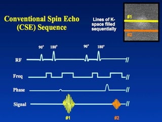 SPIN ECHO SEQUENCES MRI PPT | PPTX
