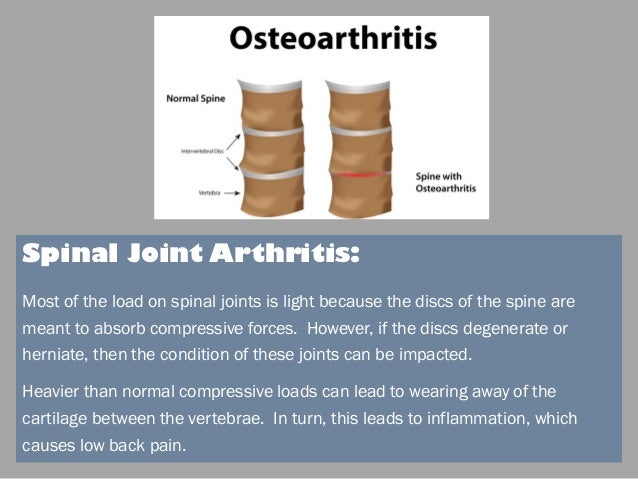 Why Does My Back Hurt? Identifying the Cause of Back Pain