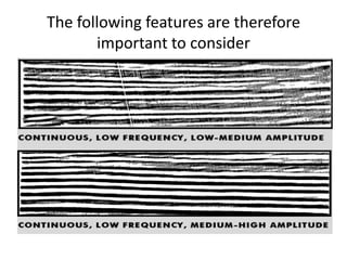 The following features are therefore
important to consider
 