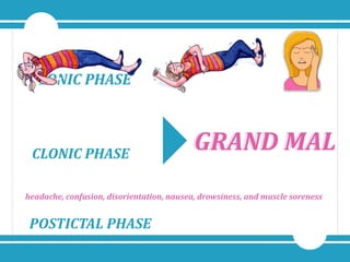 TONIC&PHASE
CLONIC&PHASE
POSTICTAL)PHASE
GRAND&MALGRAND&MAL
headache,'confusion,'disorientation,'nausea,'drowsiness,'and'muscle'soreness
 
