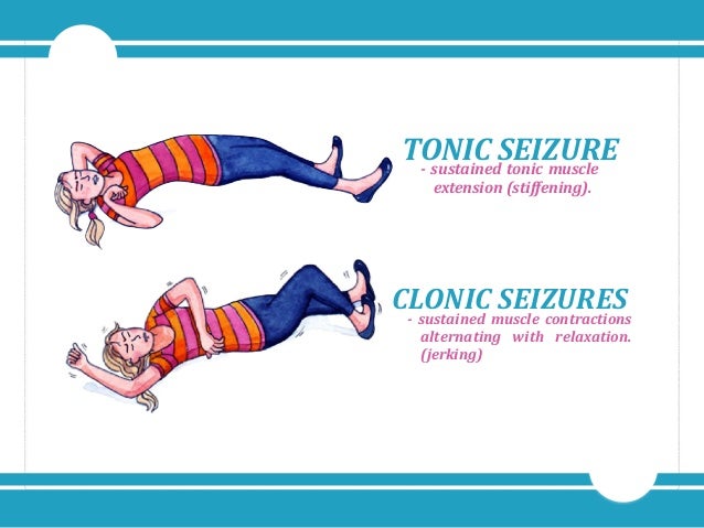 Seizure