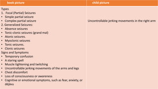 book picture child picture
Types
1. Focal (Partial) Seizures
• Simple partial seizure
• Complex partial seizure
2. Generalized Seizures:
• Absence seizures
• Tonic-clonic seizures (grand mal)
• Atonic seizures.
• Myoclonic seizures
• Tonic seizures.
• Clonic seizures
Signs and Symptoms
• Temporary confusion
• A staring spell
• Muscle tightening and twitching
• Uncontrollable jerking movements of the arms and legs
• Chest discomfort
• Loss of consciousness or awareness
• Cognitive or emotional symptoms, such as fear, anxiety, or
déjàvu
Uncontrollable jerking movements in the right arm
 