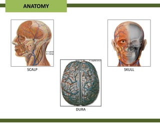 ANATOMY




 SCALP           SKULL




          DURA
 