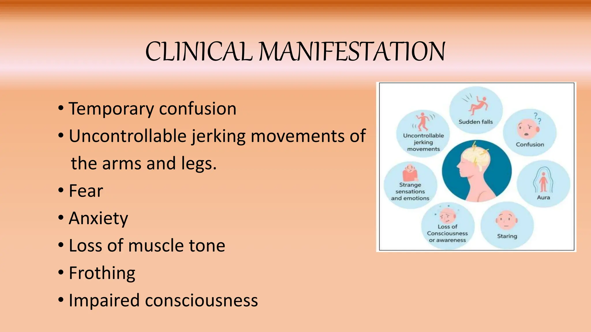 SEIZURE: Definition, Etiology, Clinical manifestations, Diagnosis ...