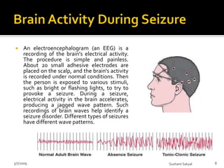 Seizure Disorder