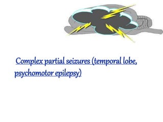 Complex partial seizures (temporal lobe,
psychomotor epilepsy)
 