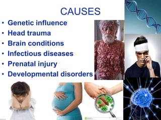 CAUSES
• Genetic influence
• Head trauma
• Brain conditions
• Infectious diseases
• Prenatal injury
• Developmental disorders
 