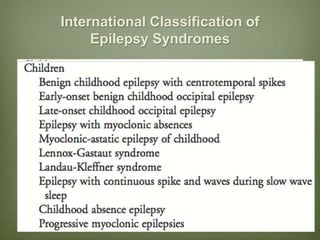 International Classification of
Epilepsy Syndromes
 