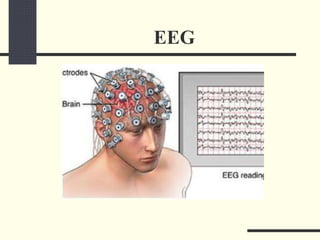 EEG
 