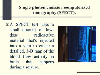Single-photon emission computerized
tomography (SPECT).
A SPECT test uses a
small amount of low-
dose radioactive
material that's injected
into a vein to create a
detailed, 3-D map of the
blood flow activity in
brain that happens
during a seizure.
 