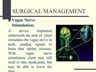 SURGICAL MANAGEMENT
Vagus Nerve
Stimulation:
A device implanted
underneath the skin of chest
stimulates the vagus nerve in
neck, sending signals to
brain that inhibit seizures.
With vagus nerve
stimulation, client may still
need to take medication, but
may be able to lower the
 