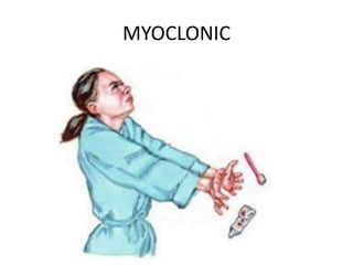 MYOCLONIC
 