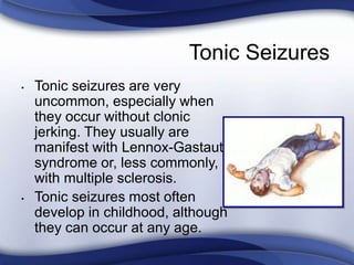 Tonic Seizures
• Tonic seizures are very
uncommon, especially when
they occur without clonic
jerking. They usually are
manifest with Lennox-Gastaut
syndrome or, less commonly,
with multiple sclerosis.
• Tonic seizures most often
develop in childhood, although
they can occur at any age.
 