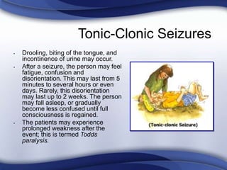 Tonic-Clonic Seizures
• Drooling, biting of the tongue, and
incontinence of urine may occur.
• After a seizure, the person may feel
fatigue, confusion and
disorientation. This may last from 5
minutes to several hours or even
days. Rarely, this disorientation
may last up to 2 weeks. The person
may fall asleep, or gradually
become less confused until full
consciousness is regained.
• The patients may experience
prolonged weakness after the
event; this is termed Todds
paralysis.
 