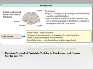 Seizures in children | PPTX