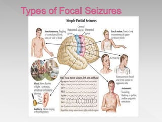 Seizures in children | PPTX