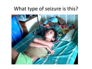 What type of seizure is this?
 