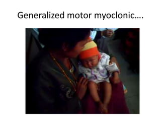 Generalized motor myoclonic….
 