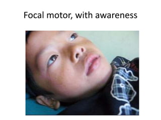 Focal motor, with awareness
 