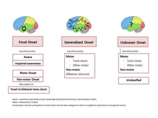 Seizure types