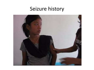 Seizure history
 