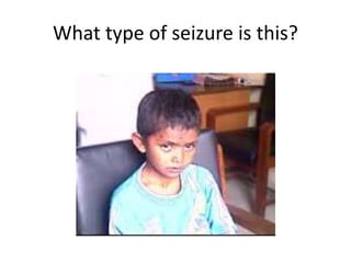 What type of seizure is this?
 