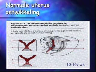 Normale uterusNormale uterus
ontwikkelingontwikkeling
10-16e wk
 