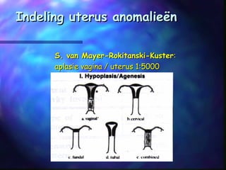 Indeling uterus anomalieënIndeling uterus anomalieën
S. van Mayer-Rokitanski-KusterS. van Mayer-Rokitanski-Kuster::
aplasie vagina / uterus 1:5000aplasie vagina / uterus 1:5000
 