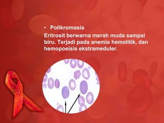 • Polikromasia
Eritrosit berwarna merah muda sampai
biru. Terjadi pada anemia hemolitik, dan
hemopoeisis ekstrameduler.
 