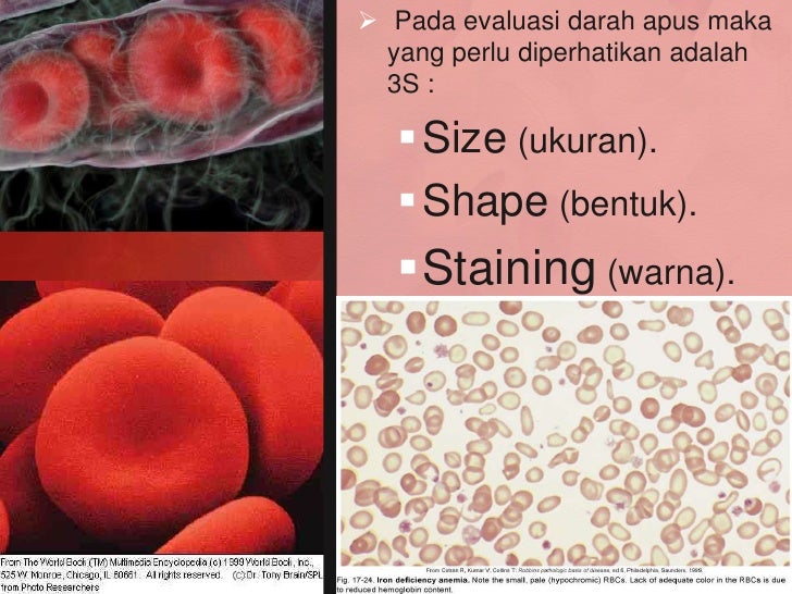 Sel darah merah Sel darah merah