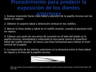 Procedimiento para predecir la
            exposición de los dientes
                              anterioresde la papilla incisiva con los
1. Evaluar expresión facial, tono labial y posición
labios en reposo.

2. Obtener el soporte labial y dimensión vertical en los rodillos.

3. Marcar la línea media y labial en el rodillo maxilar, cuando el paciente esté
en reposo.

4. Colocar una parte de una pinza de curación en el lado del tejido en la
papilla incisiva, alineándola y colocando la otra parte contra la superﬁcie
labial del rodillo maxilar. Se marca una línea horizontal para indicar el nivel
vertical de la papila.

5. La exposición de los dientes anteriores es la distancia entre la línea labial
en reposo y la línea de la papilla incisiva.




     Won suk, Hansen. Incisive papilla line as a guide to predict maxillary anterior tooth display. J Prosthet Dent 2009; 102:
     194-196
 